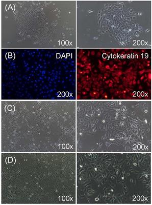 Transcriptomic Analyses Reveal the Protective Immune Regulation of Conjugated Linoleic Acids in Sheep Ruminal Epithelial Cells